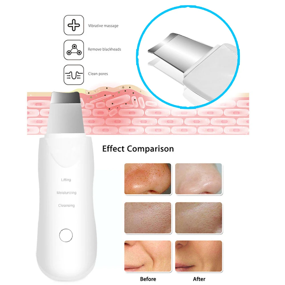 Ultrasonic Skin Scrubber Deep Vibrate Facial Cleaner