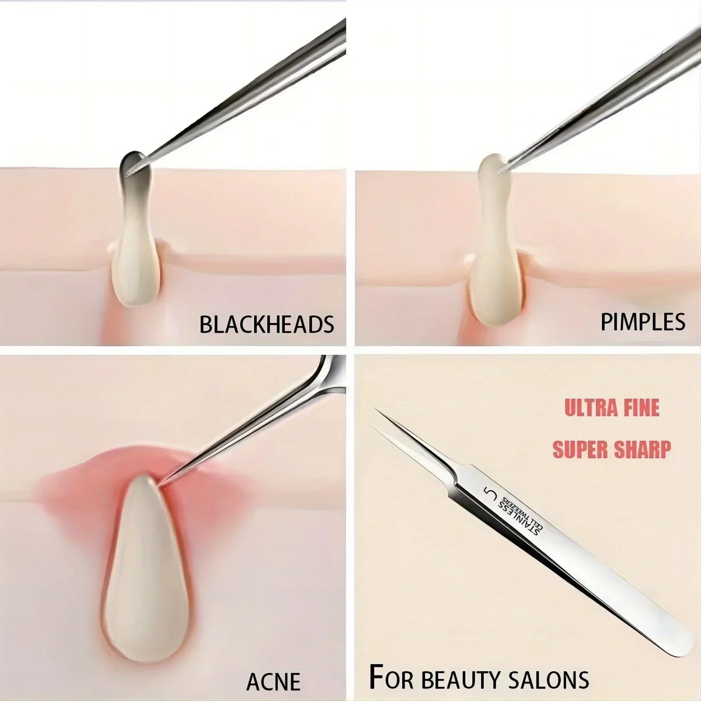 Cellular Acne Blackhead Tweezers